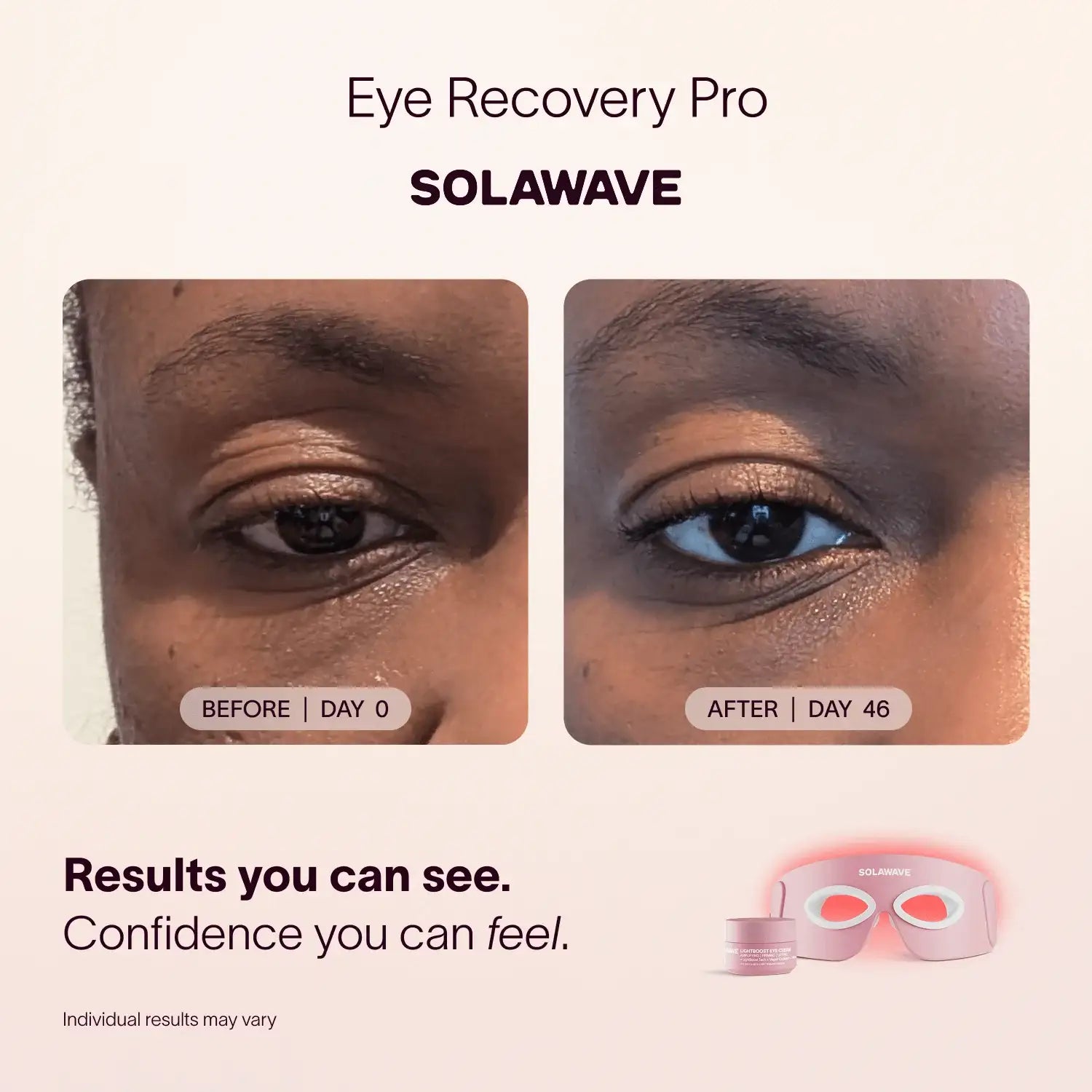 Solawave Eye Recovery Pro Kit
